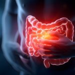 Medical illustration of the digestive system with the intestines highlighted in red, representing inflammation or gut discomfort