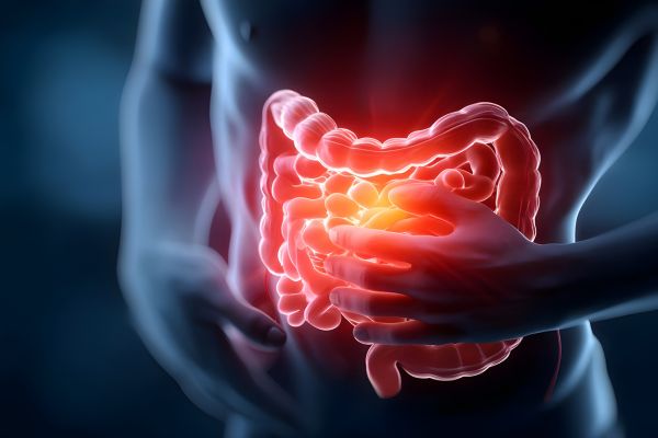 Medical illustration of the digestive system with the intestines highlighted in red, representing inflammation or gut discomfort
